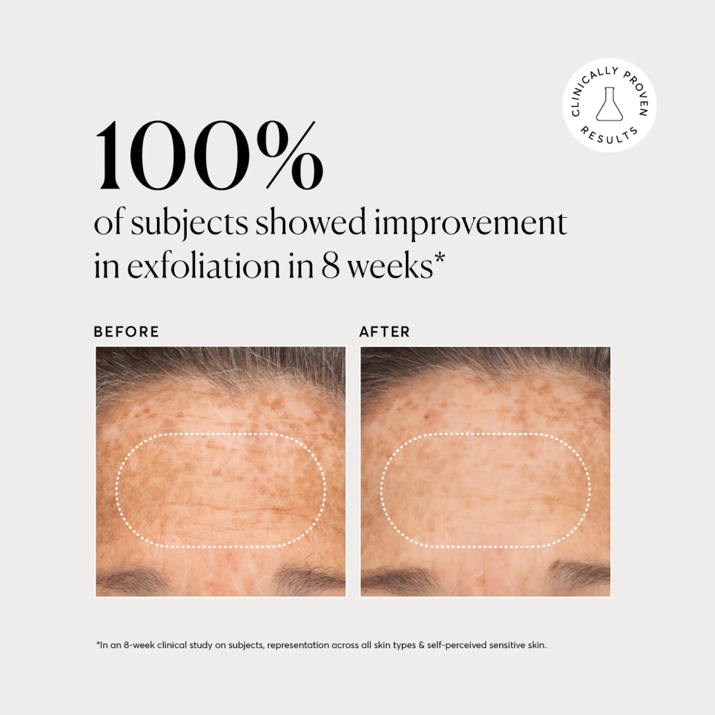 bha-liquid-exfoliant-2-c4 NATR-10027-Alt-Images-BHA-Liquid-Exfoliant-2_-03.webp